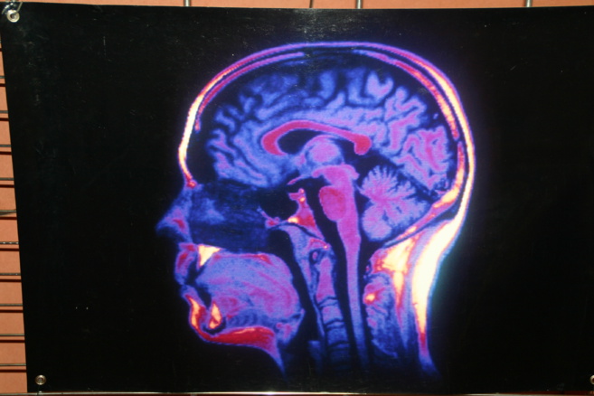 Tous les secrets du cerveau exposés en couleur à la bibliothèque universitaire de Gap Tous les secrets du cerveau exposés en couleur à la bibliothèque universitaire de Gap