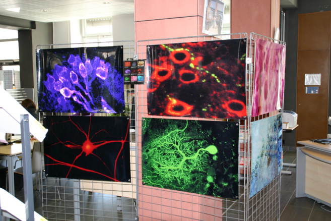 Tous les secrets du cerveau exposés en couleur à la bibliothèque universitaire de Gap
