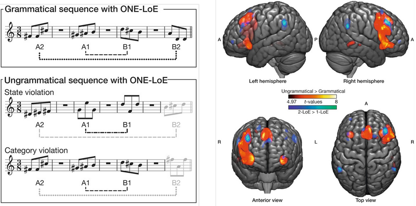Chronique Caro: La musique et ses effets sur notre cerveau