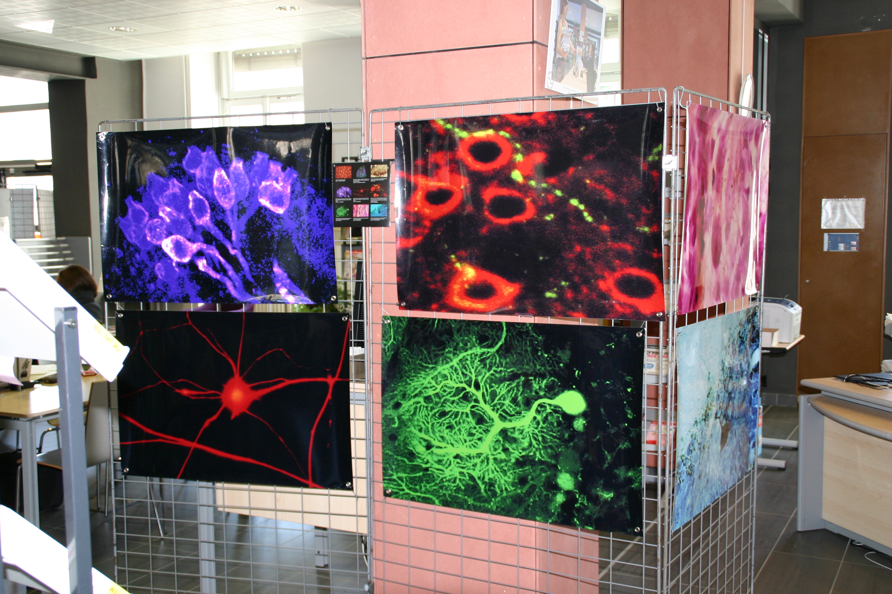 Tous les secrets du cerveau exposés en couleur à la bibliothèque universitaire de Gap
